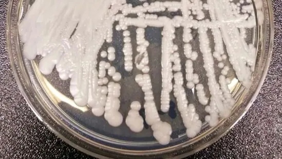 candida auris