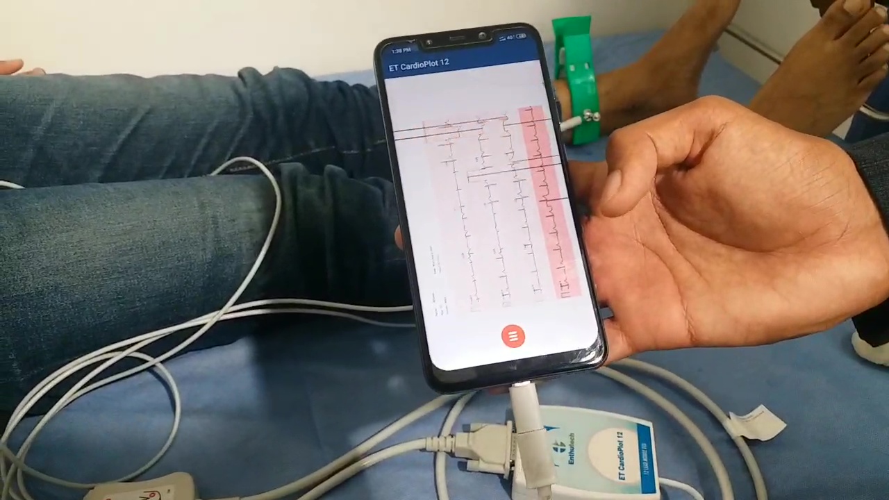 ECG on smartphone within a minute