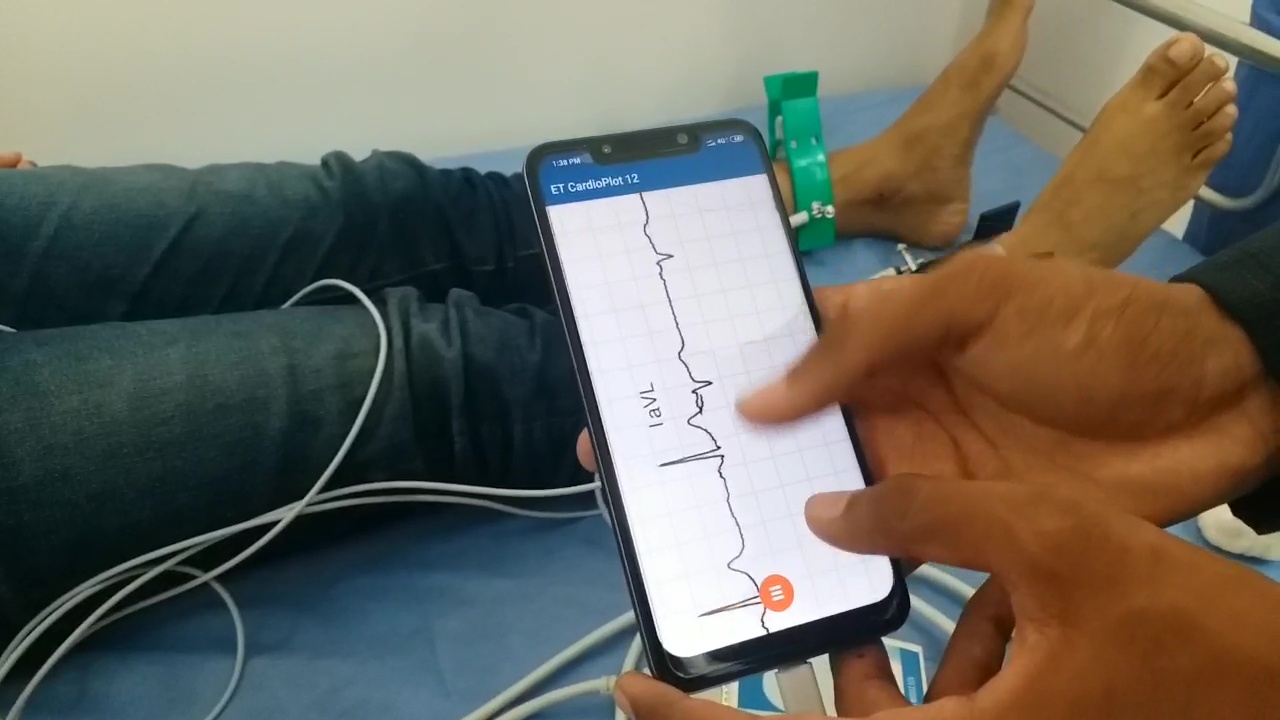 ECG on smartphone within a minute