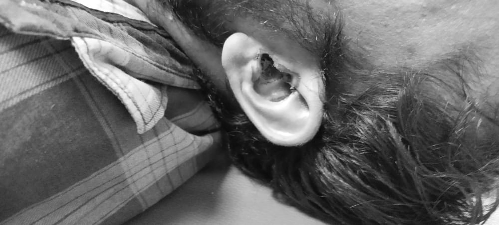 bluetooth earphone death rajasthan, ఇయర్​ఫోన్స్​ పేలి మృతి