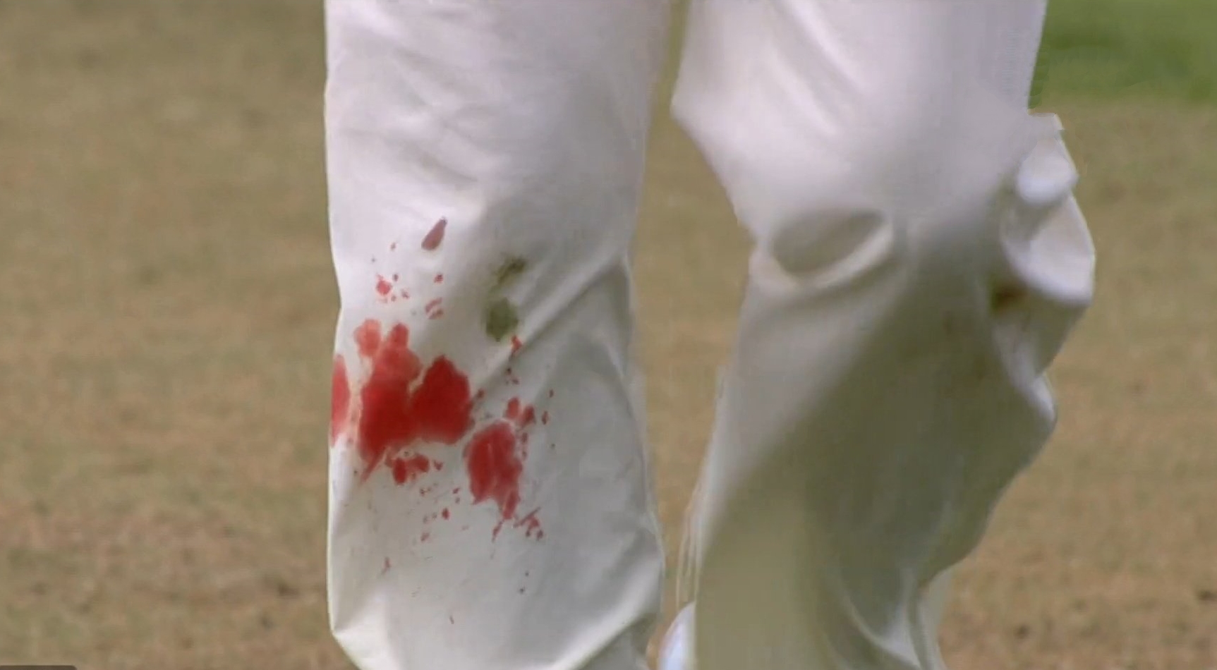 IND Vs ENG 4th Test: James Anderson bowling with blooded legs