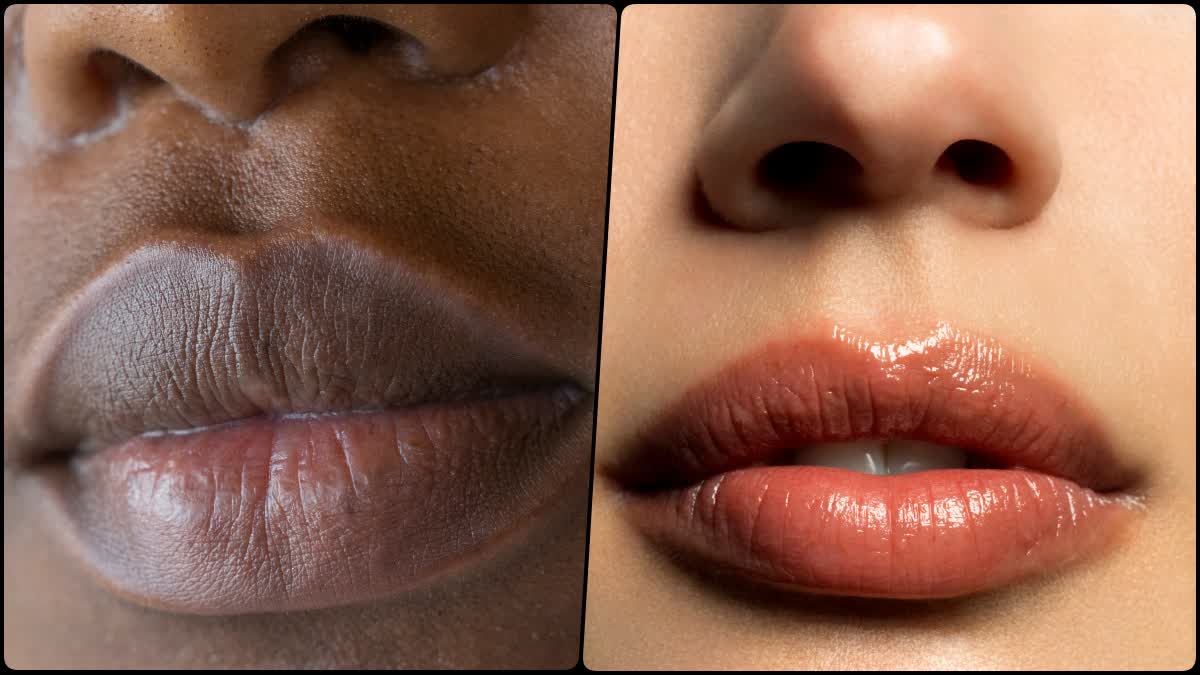 tips to lighten dark lips