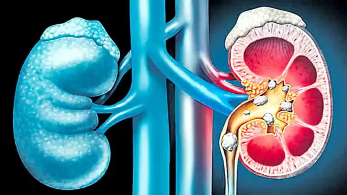 World Kidney Day 2024