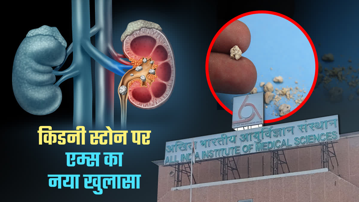 दिल्ली एम्स के शोध में सामने आए चौंकाने वाले फैक्ट