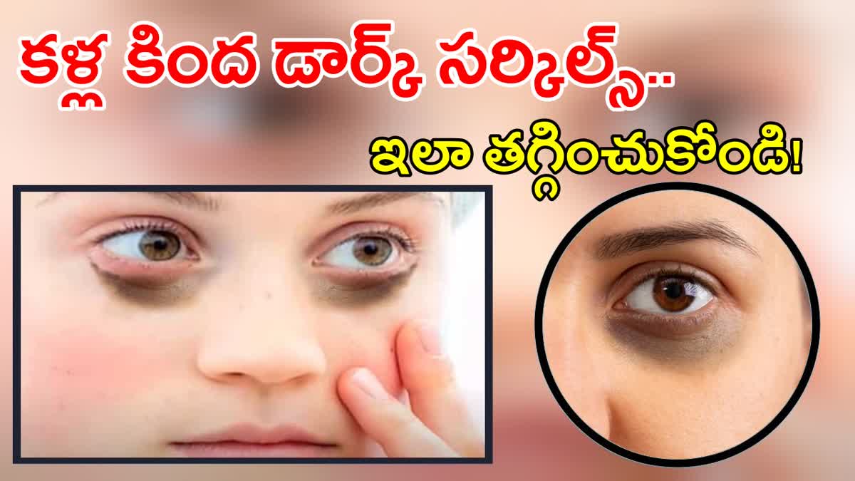 Tips to Remove Under Eye Dark Circles
