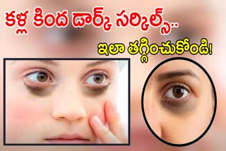 Tips to Remove Under Eye Dark Circles