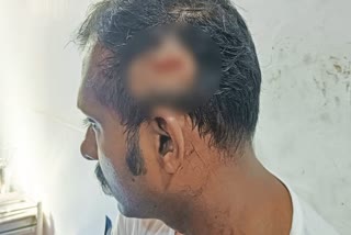 POLICEMAN ATTACKED KAZHAKOOTTAM  POLICE AND PEOPLE CONFLICT  പൊലീസ് ഉദ്യോഗസ്ഥന് മര്‍ദനം  കഴക്കൂട്ടം ഉത്സവത്തില്‍ സംഘര്‍ഷം