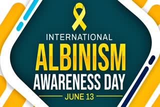 World Albinism Awareness Day: Reason, Significance, Theme 2024