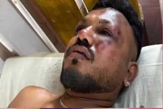 : کیا آپ جانتے ہیں کہ جہاز میں سیٹ نمبر 11-A کہاں ہے، جس نے وشواس کی جان بچائی
