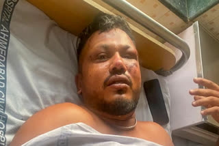 PLANE CRASH SURVIVOR