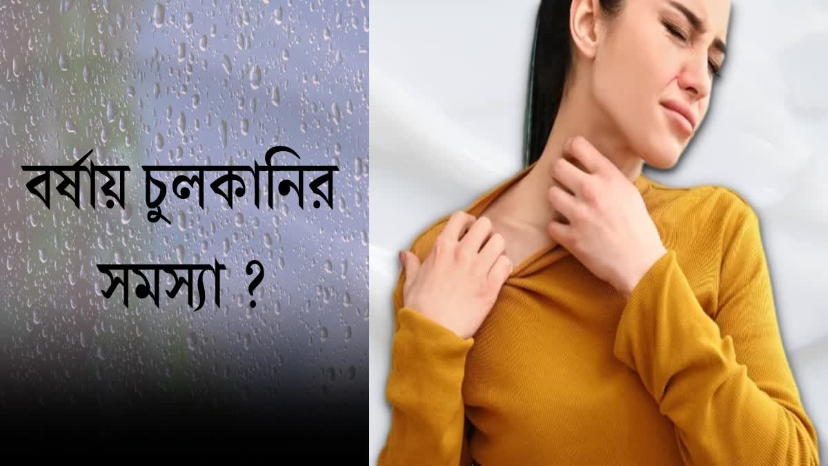 Itching problem In monsoon News