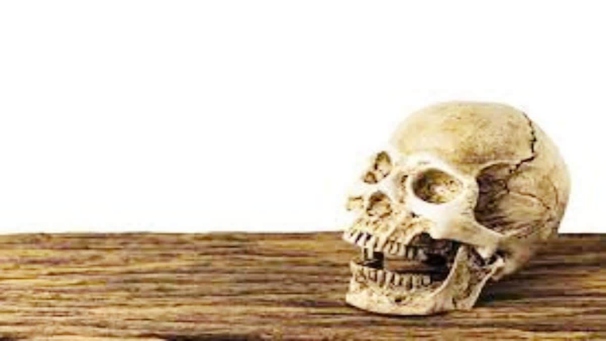 Representative image of skull