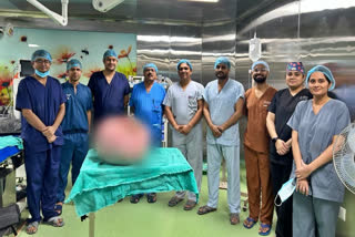 tumour removed  15 കിലോയുള്ള മുഴ നീക്കം ചെയ്‌തു  TUMOUR REMOVED FROM WOMANS BODY  15 KG TUMOUR REMOVED FROM WOMANS BODY  INDORE HOSPITAL  സ്‌ത്രീയുടെ വയറ്റിൽ നിന്ന് 15 കിലോയുള്ള മുഴ  മുഴ നീക്കം ചെയ്‌തു