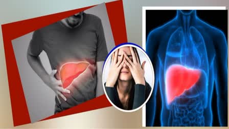 Symptoms of Liver Damage