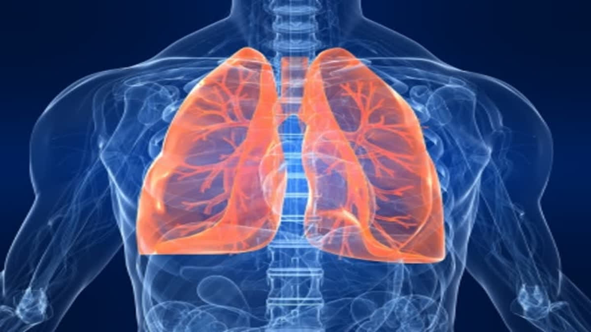 There is increasing data that show a persistently impaired pulmonary function upon recovery after severe infection.