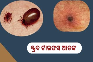 ରାଜ୍ୟରେ ବଢ଼ୁଛି ସ୍କ୍ରବ ଟାଇଫସ