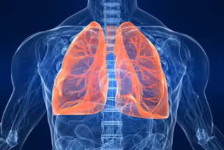 There is increasing data that show a persistently impaired pulmonary function upon recovery after severe infection.