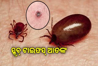 ସ୍କ୍ରବ୍ ଟାଇଫସ୍‌ ମୁକାବିଲା ପାଇଁ  ଜିଲ୍ଲା ସ୍ଵାସ୍ଥ୍ୟ ବିଭାଗ ସମ୍ପୂର୍ଣ୍ଣ  ପ୍ରସ୍ତୁତ