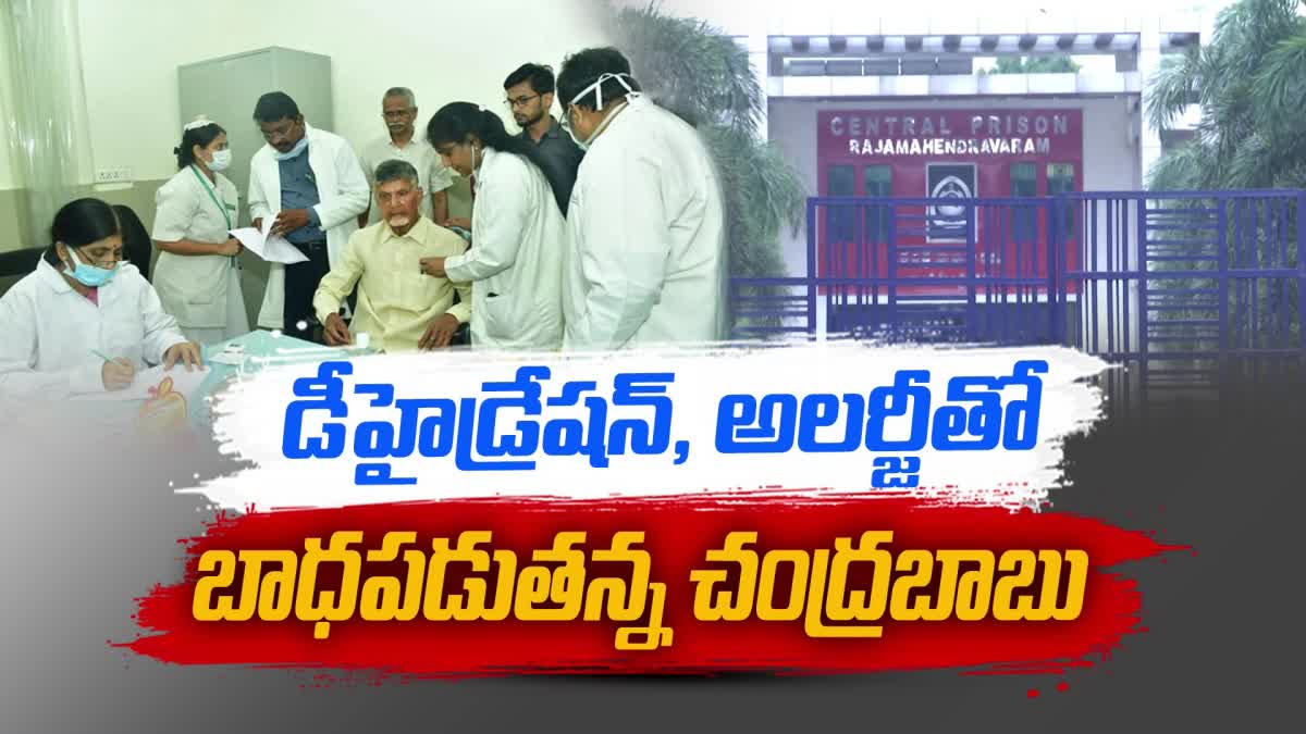 Chandrababu Illness In Jail