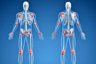 ARTHRITIS CAUSES SYMPTOMS AND KNOW ARTHRITIS TYPES WITH TREATMENT ADVICE