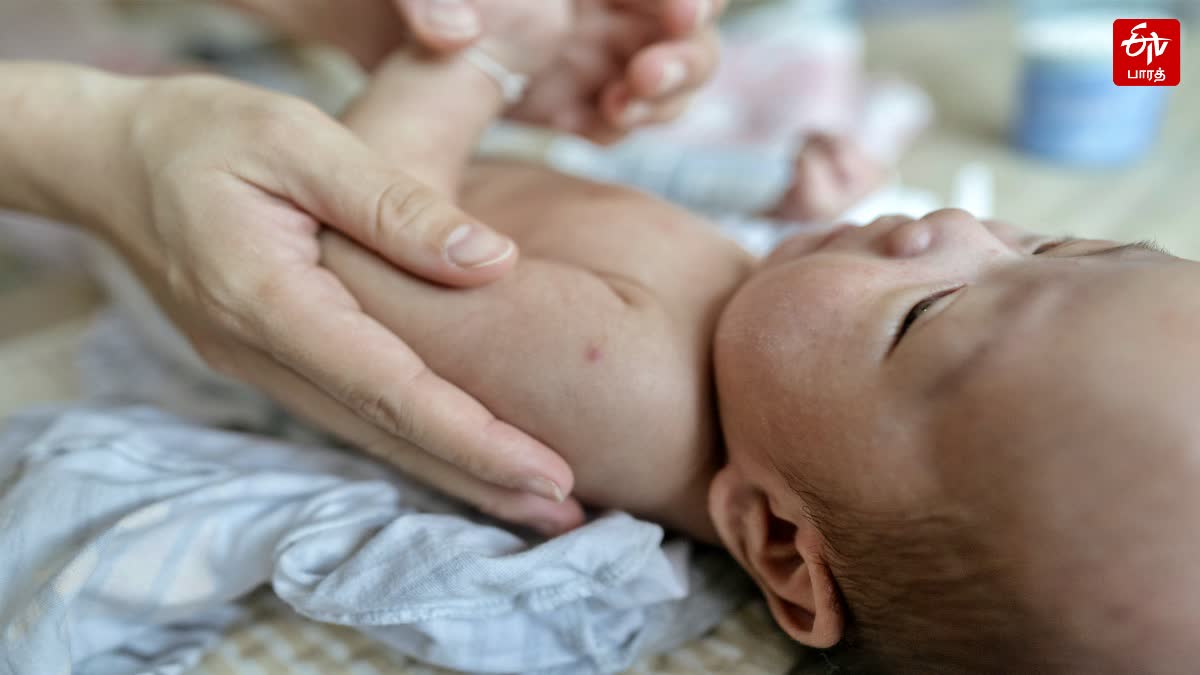 Precautions to Avoid Dry Baby Skin