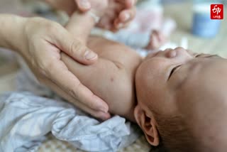 Precautions to Avoid Dry Baby Skin