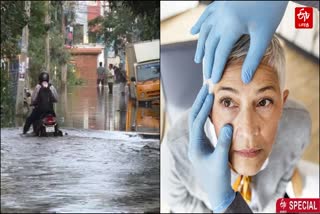 doctor explained eye problems caused by stagnant rain water