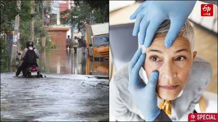 doctor explained eye problems caused by stagnant rain water