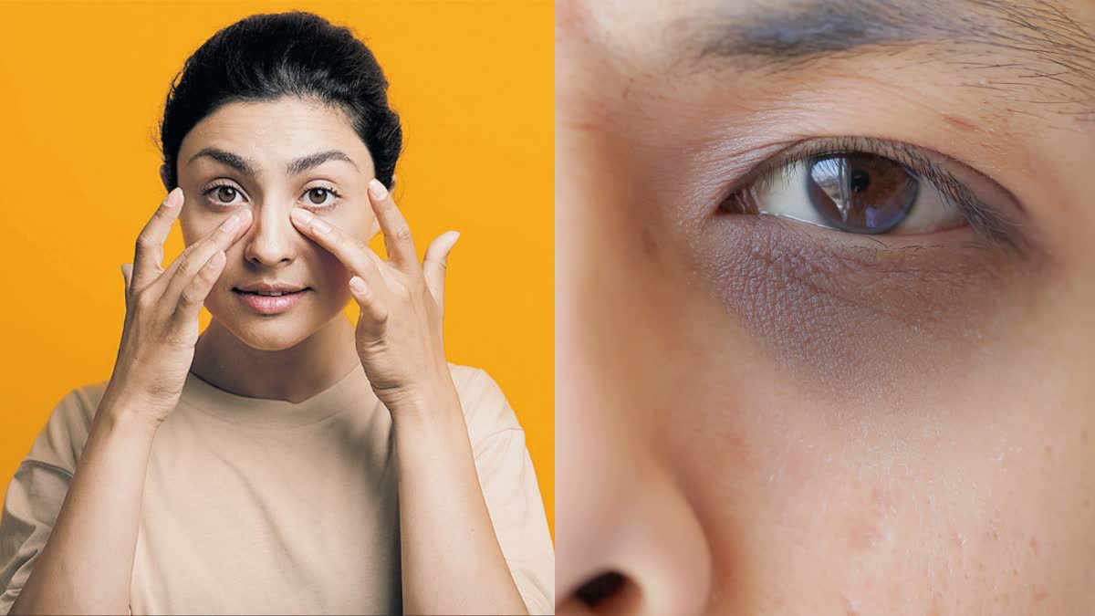 dark circles remove tips