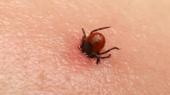 Scrub Typhus reported in five districts of MP, Government issues alert