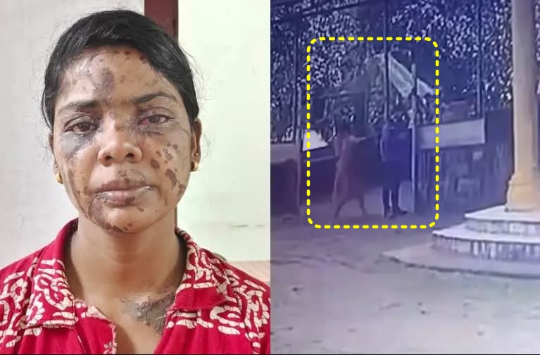 acid attack