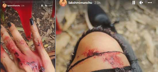 manchu lakshmi injury