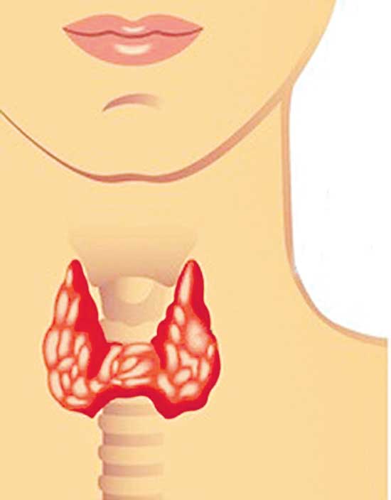 Thyroid in Kids