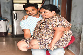 Love Is When I Hold And Carry Her To Places, Says Man After Wife Loses Legs To Accident