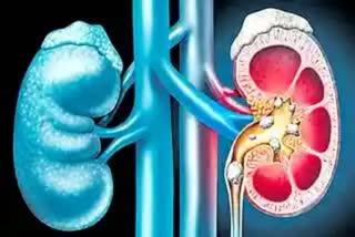 facts about chronic kidney disease and world kidney day theme