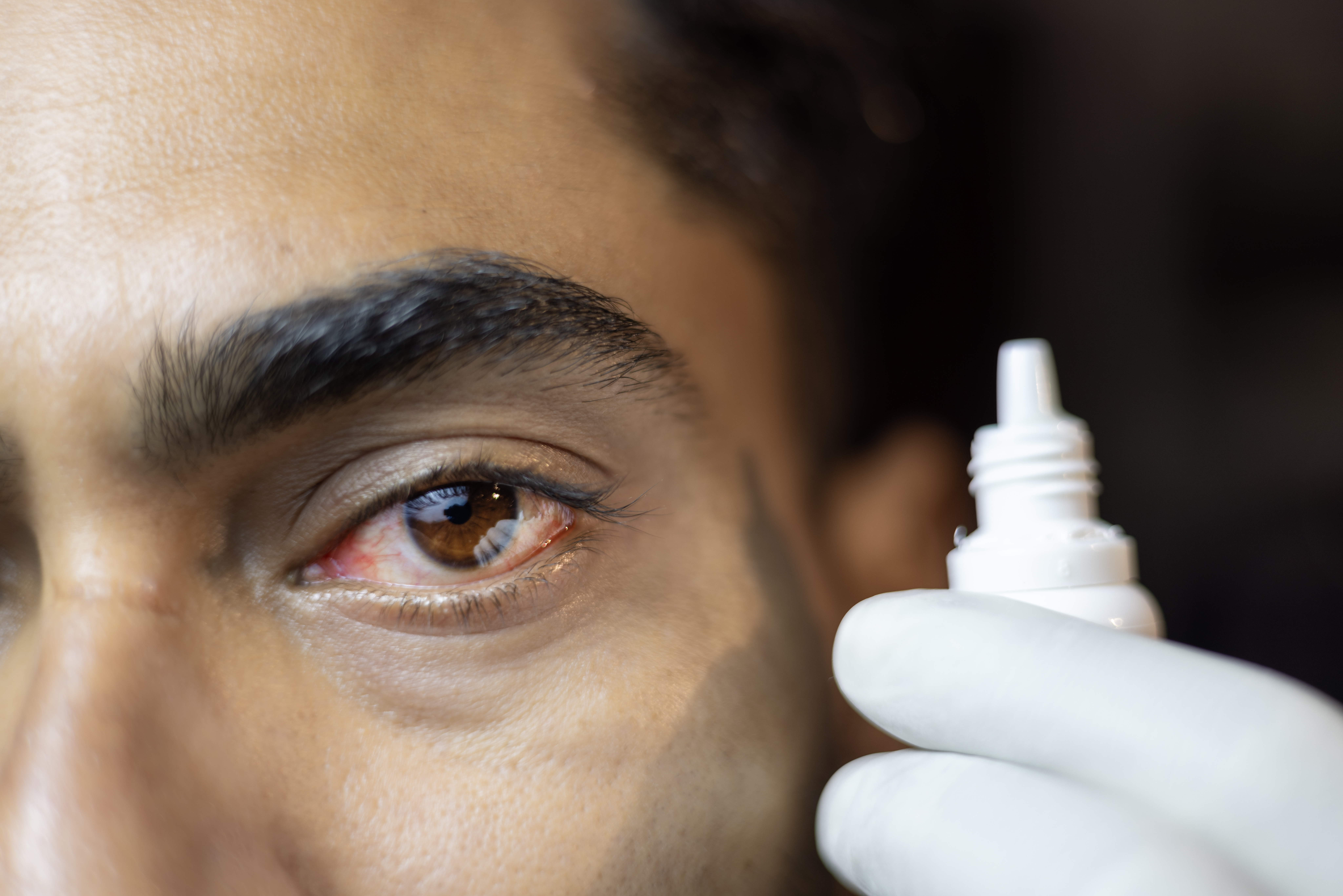 eye drops