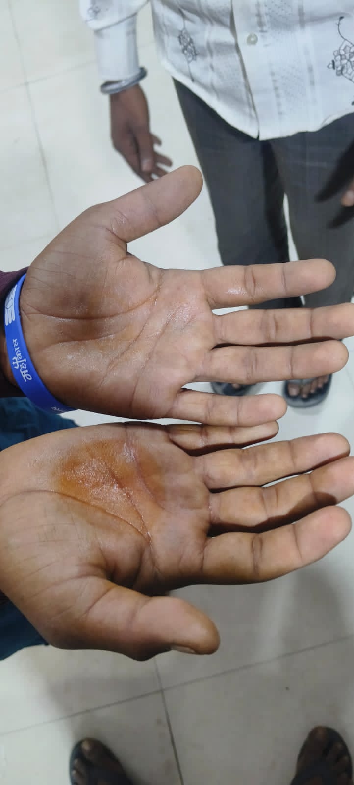 Morena Police beat two people