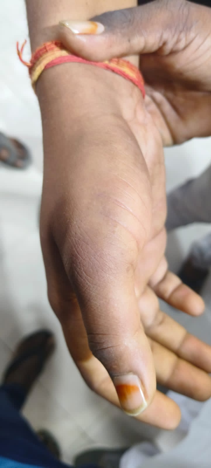 Morena Police beat two people