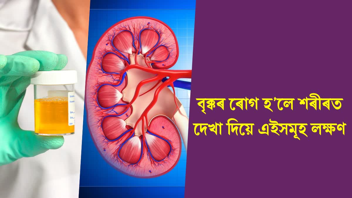 Kidney Disease Symptoms