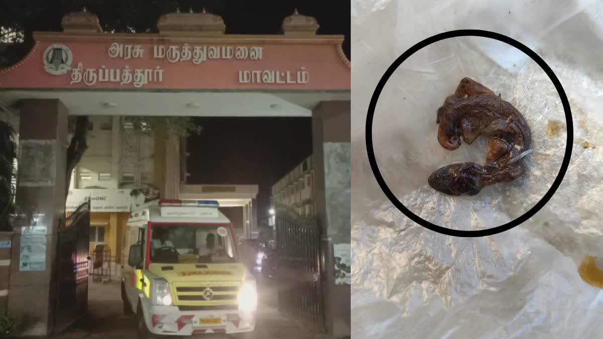 திருப்பத்தூர் அரசு மருத்துவமனை, கூல்டிரிங்ஸ் பாட்டிலில் இருந்த பல்லி