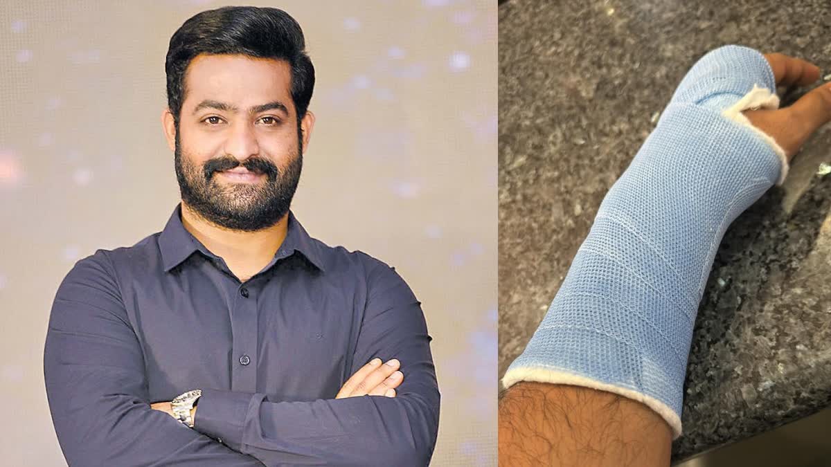 jr ntr injury update today