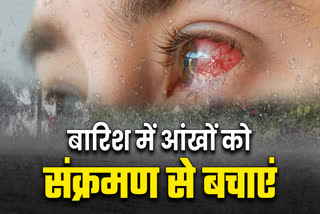 EYE DISEASES DURING MONSOON