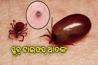 ସୁନ୍ଦରଗଡ଼ରେ ସ୍କ୍ରବ ଟାଇଫସ ଆତଙ୍କ