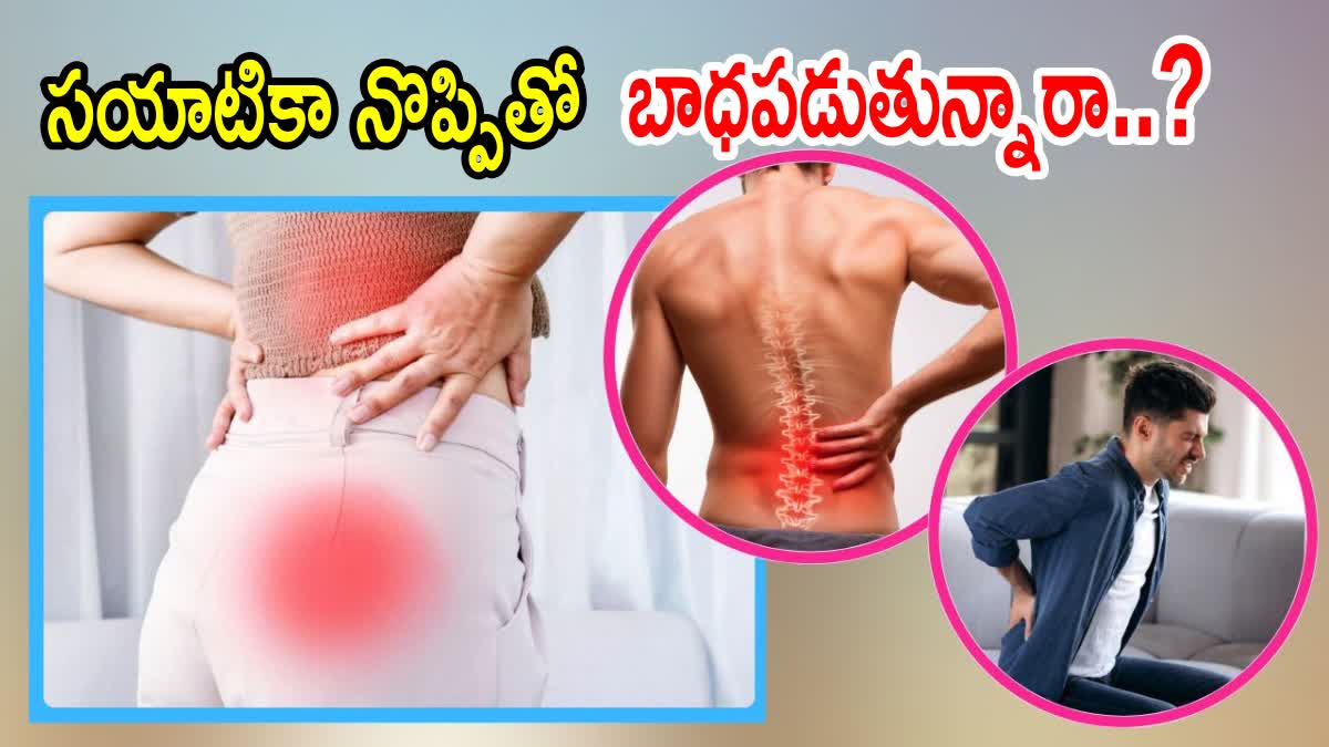 SCIATICA PAIN RELIEF TIPS