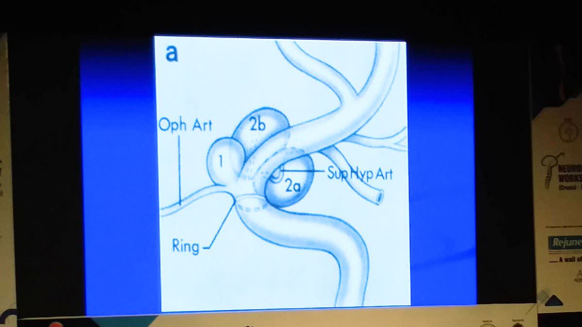 Neuro Endoscopy Conference