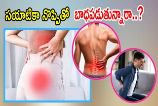 SCIATICA PAIN RELIEF TIPS