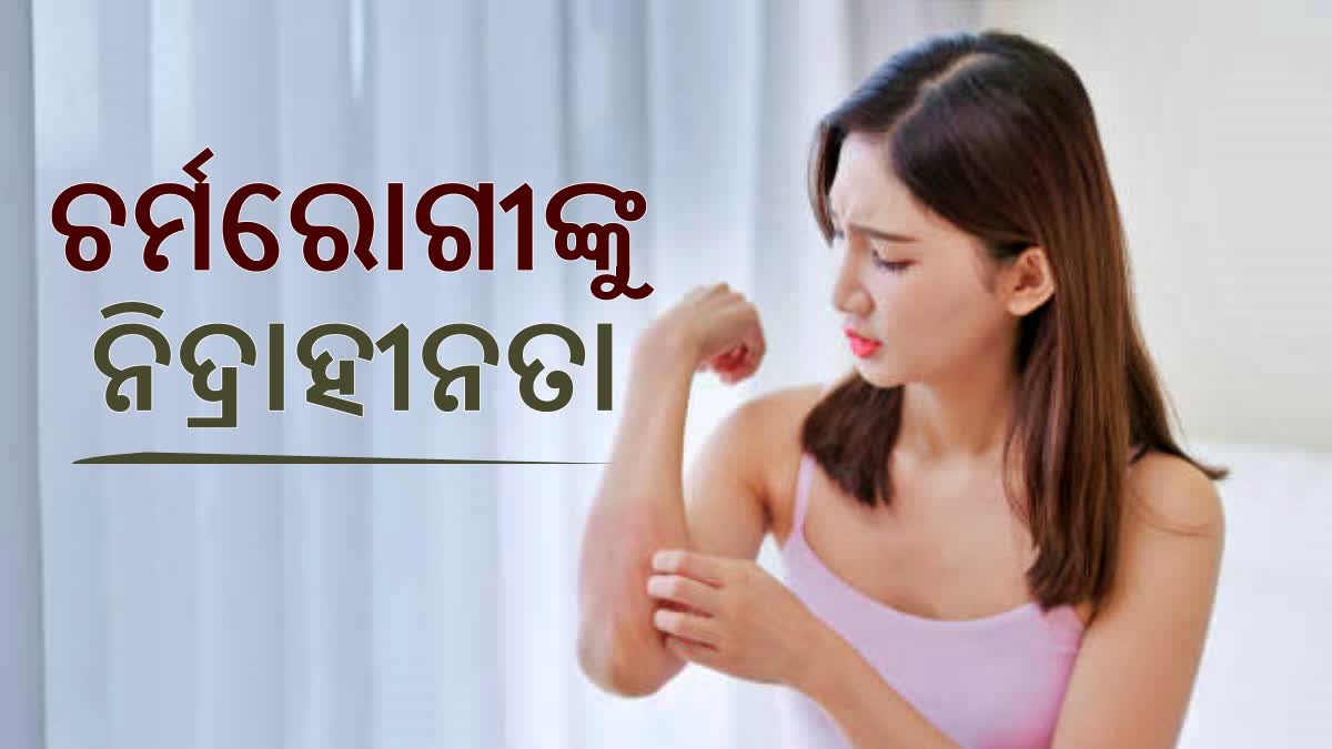 ଚର୍ମରୋଗୀ ନିଦ୍ରାହୀନତାର ଶିକାର