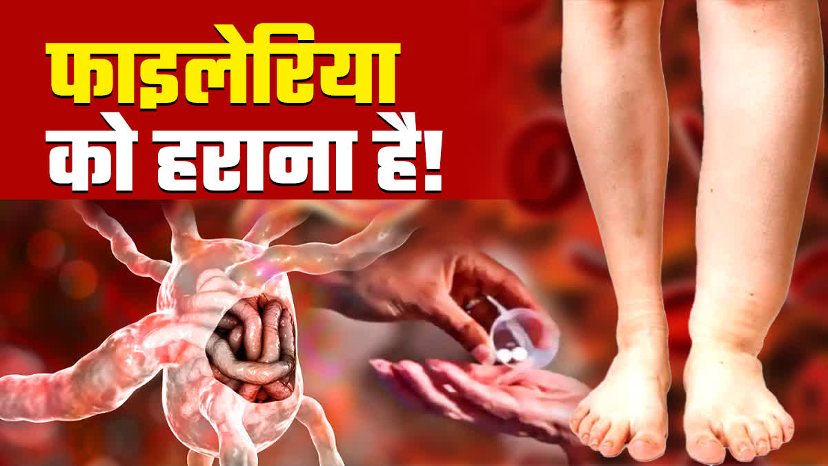 lymphatic filariasis patients Increasing in Deoghar