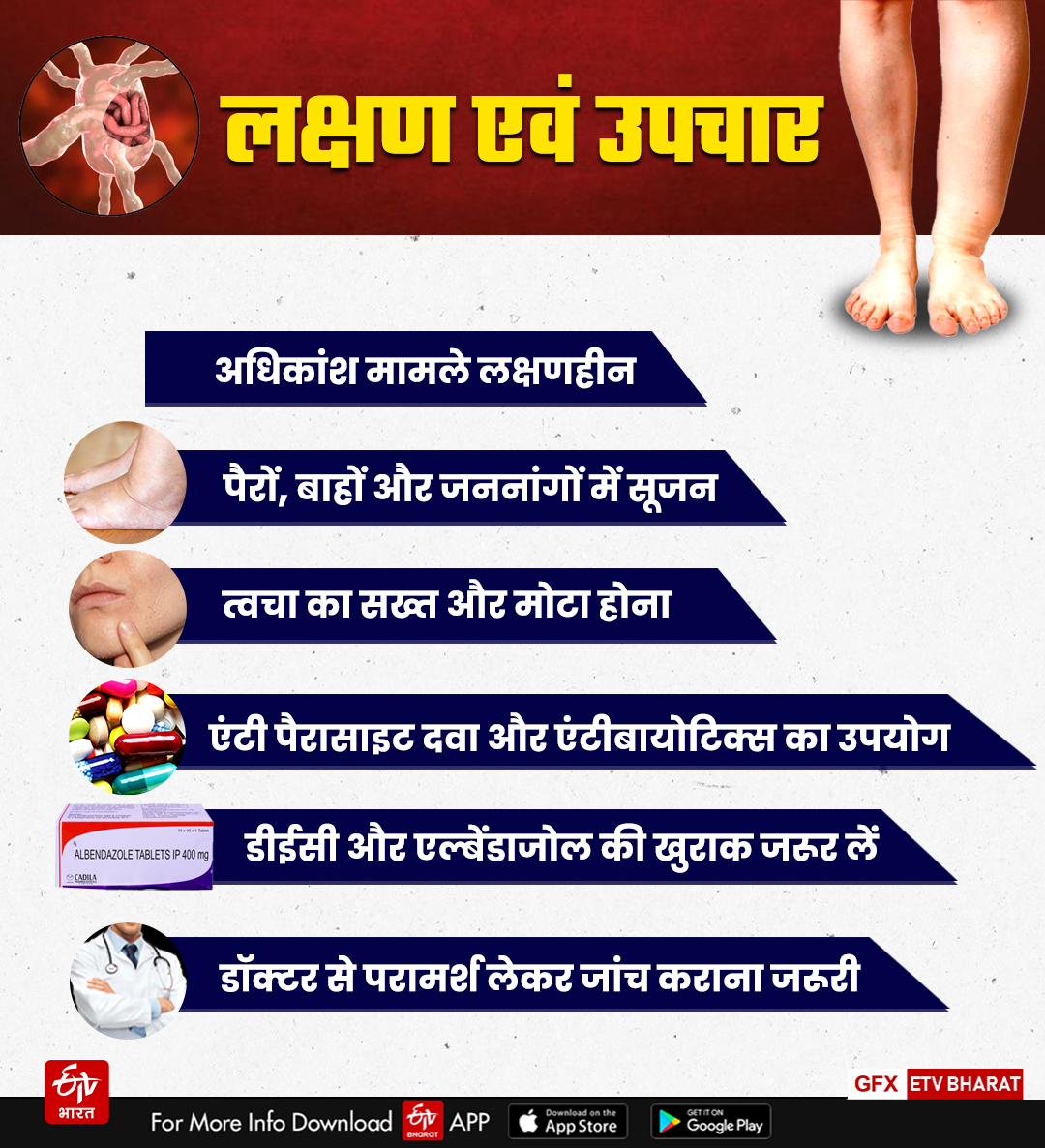 lymphatic-filariasis-patients-increasing-in-deoghar