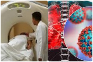 no need for CT scan in corona third wave